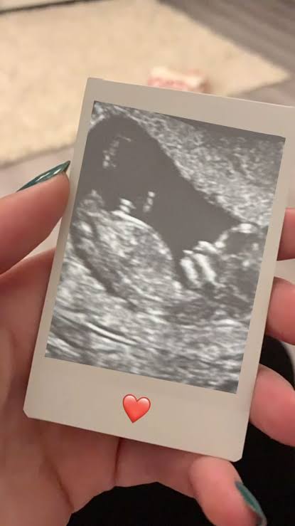 Custom Gender Reveal Hamper with Confetti Explosion | Create Your Own Baby BOY Announcement Gift